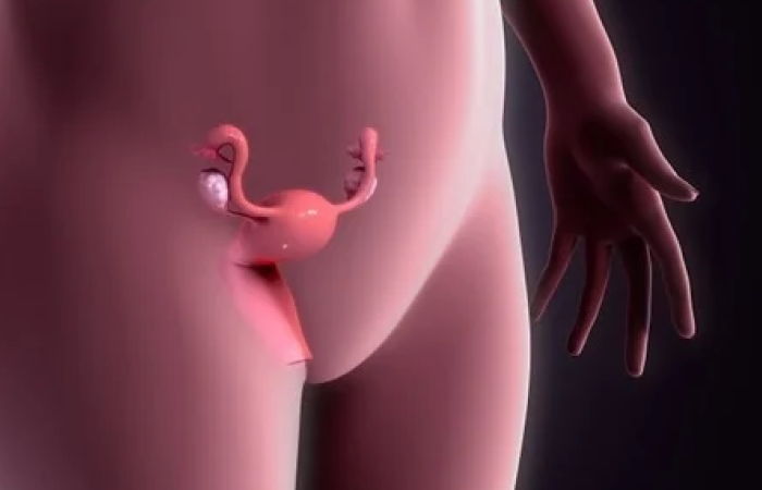 Ovarian Abnormalities Treatment in Dubai