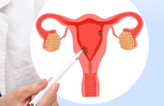 Dilation and Curettage in Dubai