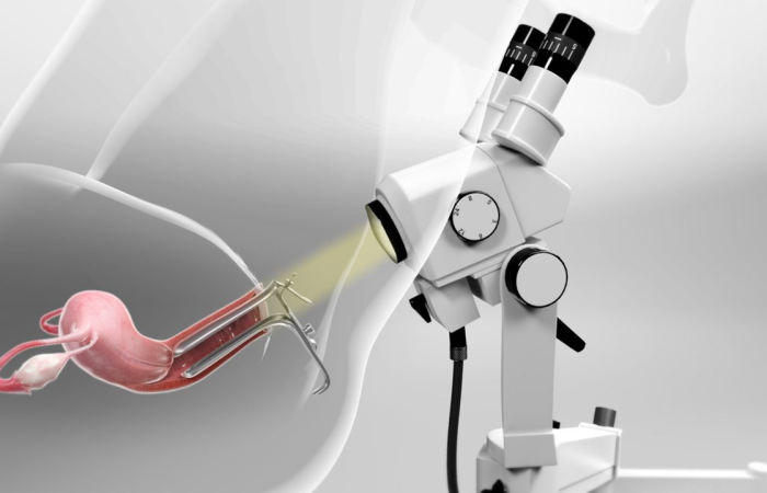 Colposcopy Dubai