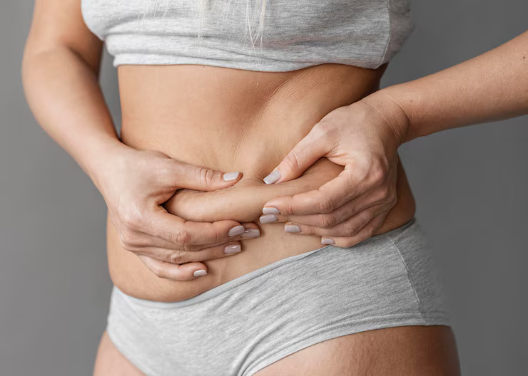 Fibroid Belly Before and After